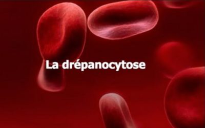 Drépanocytose : comment privilégier le bien-être des malades ?